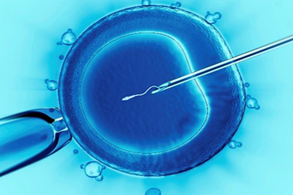 Intracytoplasmic Sperm Injection (ICSI) Treatment and Its Success Rate in Pakistan