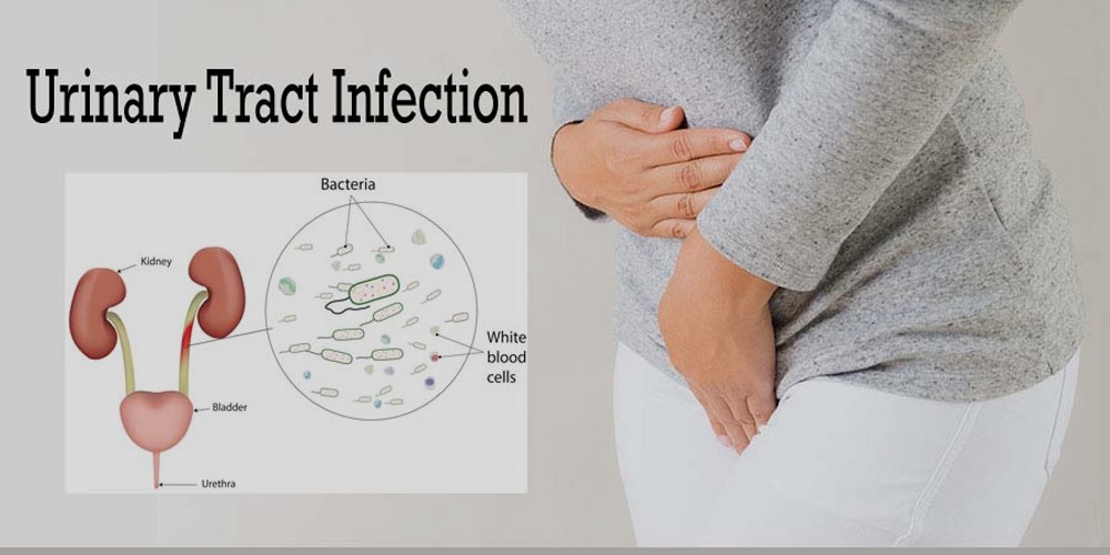 All You Need to Know About Urinary Tract Infections